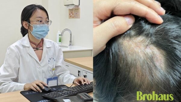 Một cái ôm với thú cưng, một mảng tóc không bao giờ mọc lại: Điều mọi ông bố có con nhỏ cần biết!